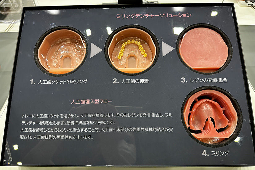ミリングデンチャーソリューションの紹介